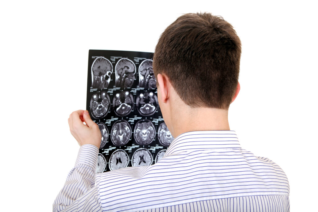 Brain Injury